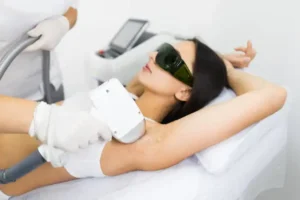 Tria laser hair removal?