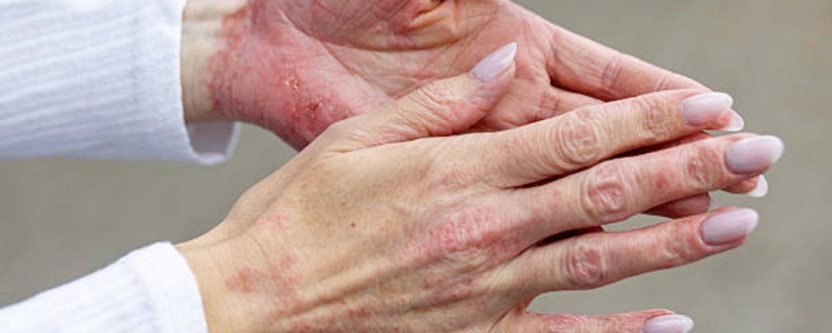 Dry and Sensitive Skin Routine 2025: Hydrating Skincare Tips & Best Products 1 Dry and Sensitive Skin Routine 2025