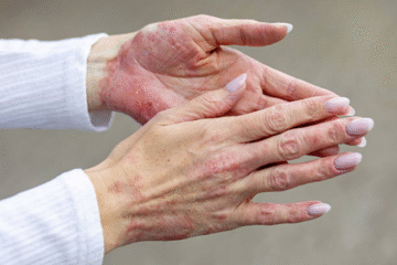 Dry and Sensitive Skin Routine 2025: Hydrating Skincare Tips & Best Products 16 Dry and Sensitive Skin Routine 2025