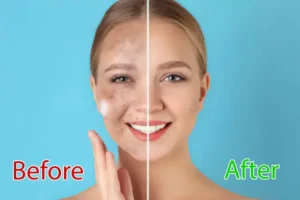Home remedy for skin whitening in 3 days?
