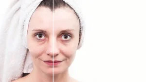 Best face treatment for wrinkles in 2025