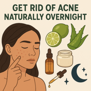 Get rid of acne naturally overnight