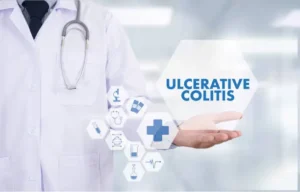 Ulcerative Colitis: Signs, Causes, and Coping Mechanisms