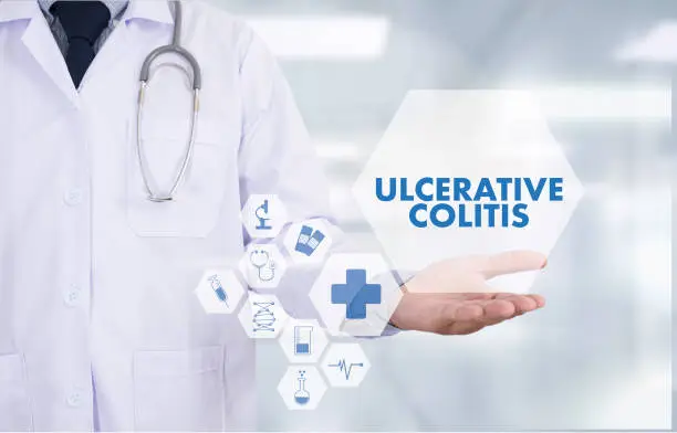 Ulcerative Colitis: Signs, Causes, and Coping Mechanisms