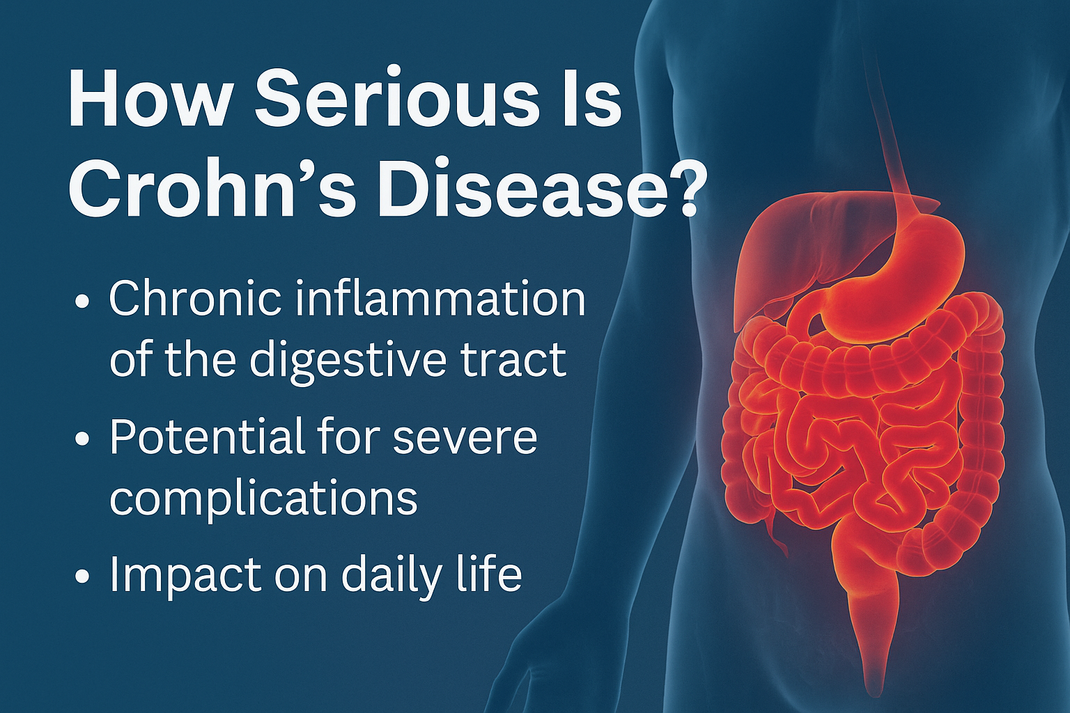 How serious is Crohn's-disease