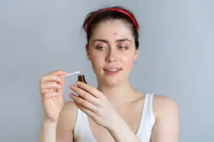 Salicylic acid good for acne