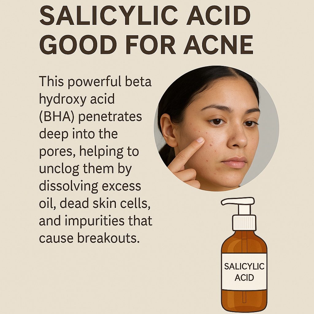 Salicylic acid good for acne