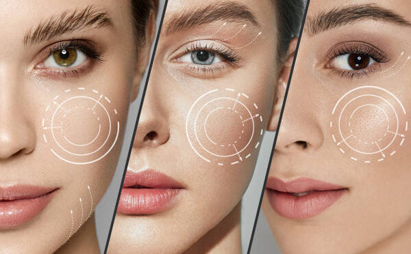 Conclusion: Finding the Right Path to Clearer Skin