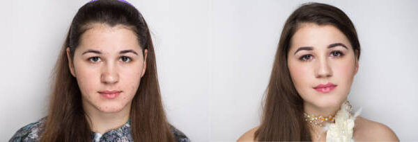 Solawave Wand Before and After — Day 7 to Day 60