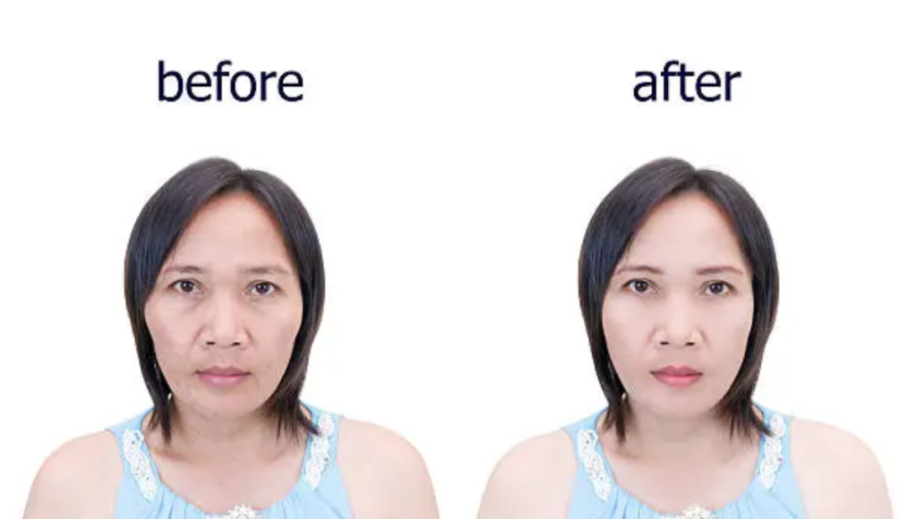 Before & After Using Collagen Drinks: What to Expect