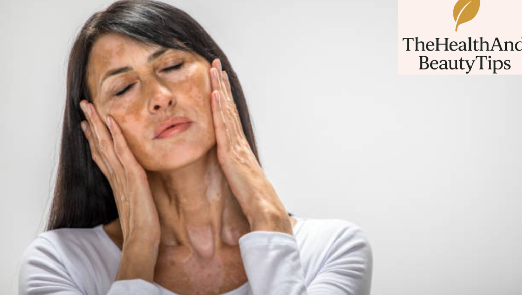 Hyperpigmentation Treatment 2025: Your Complete Guide to Clear, Even-Toned Skin 2 Common Mistakes That Make Hyperpigmentation Worse