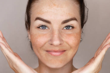 Hyperpigmentation Treatment 2025: Your Complete Guide to Clear, Even-Toned Skin