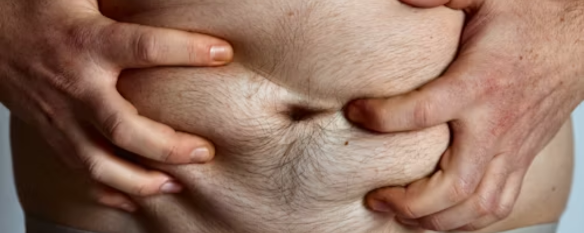 How to Improve Gut Health Naturally