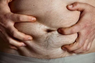 How to Improve Gut Health Naturally